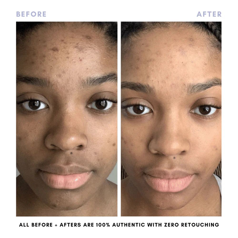 The Core Skincare Set - Image 10