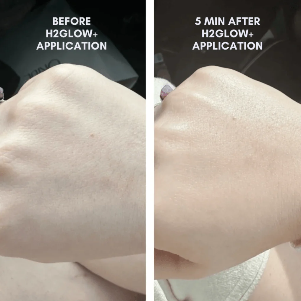 The Core Skincare Set - Image 3