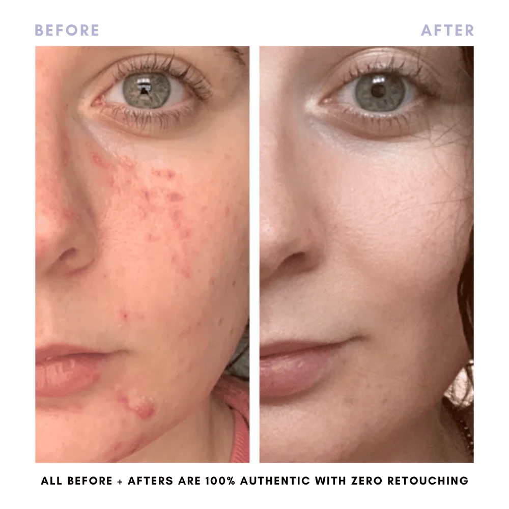 The Core Skincare Set - Image 9