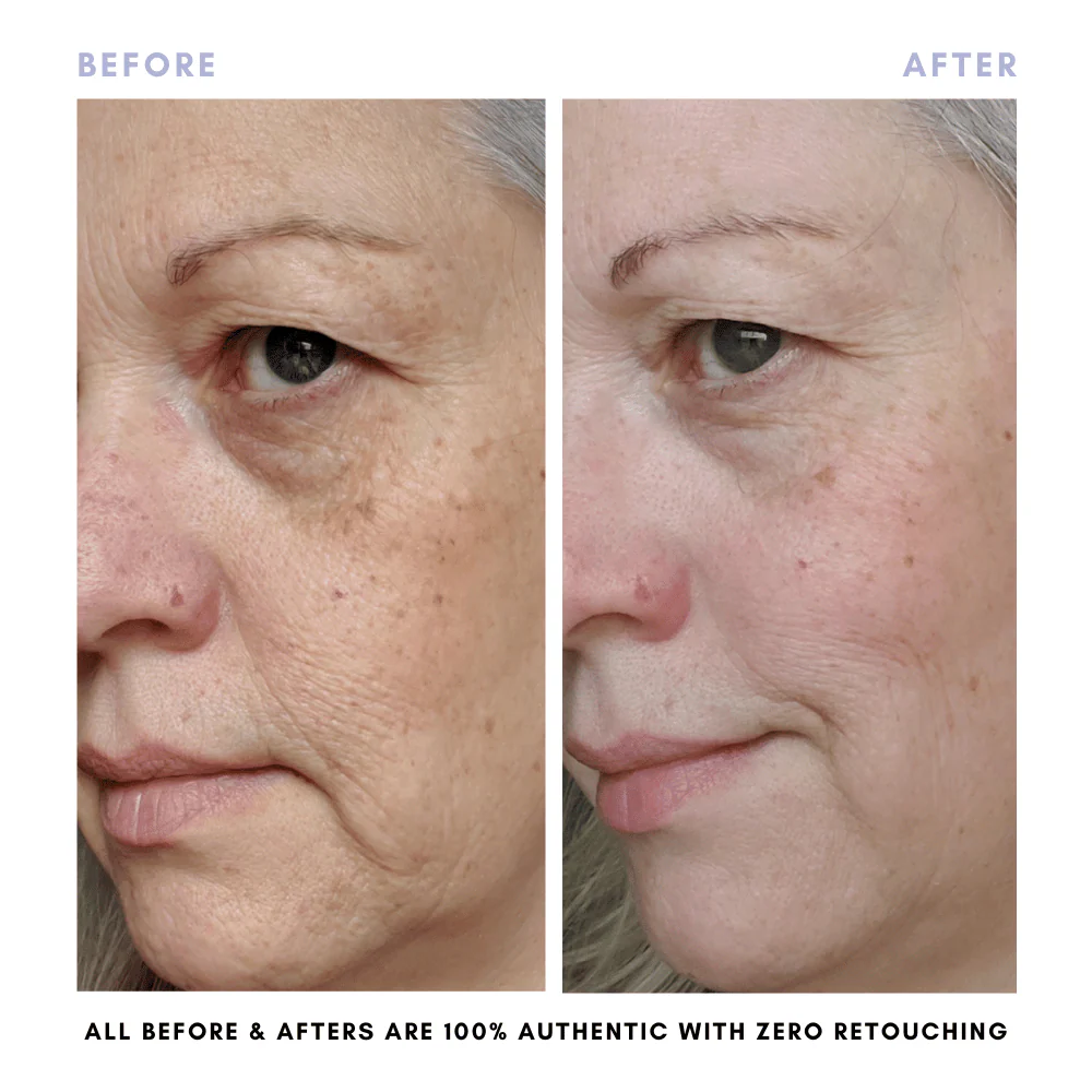 The Purifying Skincare Set - Image 9