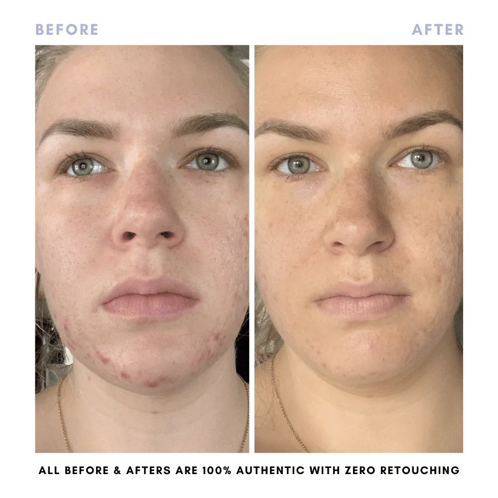 The Skin Reset Starter Kit - Image 12