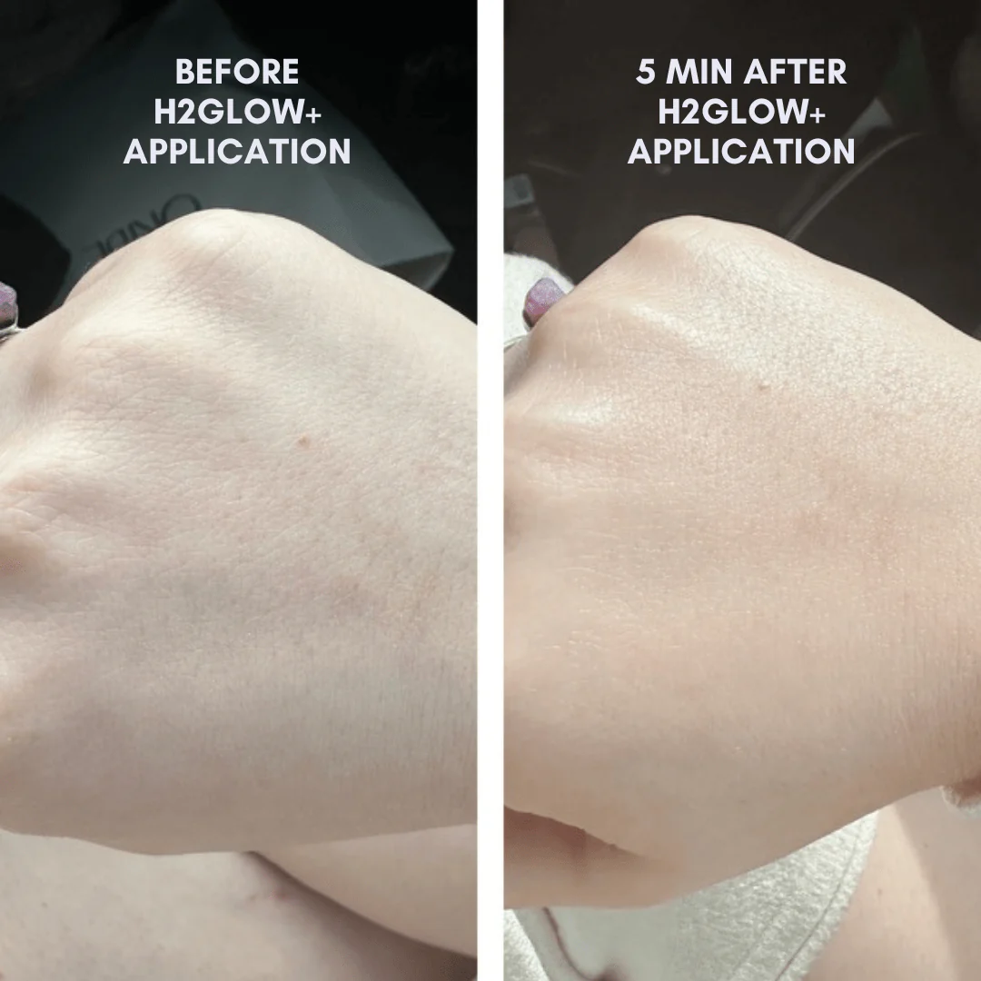 The Skin Reset Starter Kit - Image 3